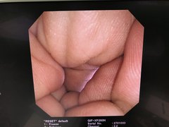 Video Transnasal Gastroscope｜GIF-XP260N｜Olympus Medical Systems photo6