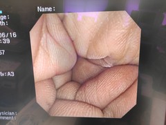 上部消化管汎用ビデオスコープ(径鼻対応)｜GIF-XP260N｜オリンパスメディカルシステムズ株式会社の写真6枚目