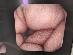 上部消化管汎用ビデオスコープ(径鼻対応)｜GIF-XP260N｜オリンパスメディカルシステムズ株式会社の写真7枚目