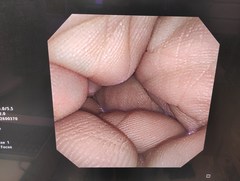 上部消化管汎用ビデオスコープ(径鼻対応)｜GIF-XP260N｜オリンパスメディカルシステムズ株式会社の写真7枚目
