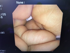 上部消化管汎用ビデオスコープ(径鼻対応)｜GIF-XP260N｜オリンパスメディカルシステムズ株式会社の写真8枚目