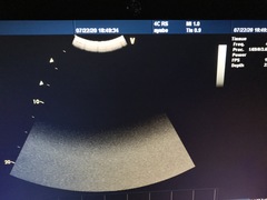 Ultrasound system(Color)｜Vivid i｜GE Healthcare photo18