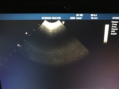 Ultrasound system(Color)｜Vivid i｜GE Healthcare photo20