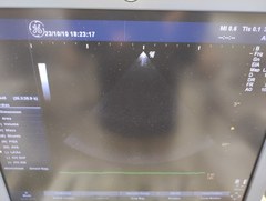 超音波診断装置（カラードプラ）｜LOGIQ P6｜GEヘルスケアの写真20枚目